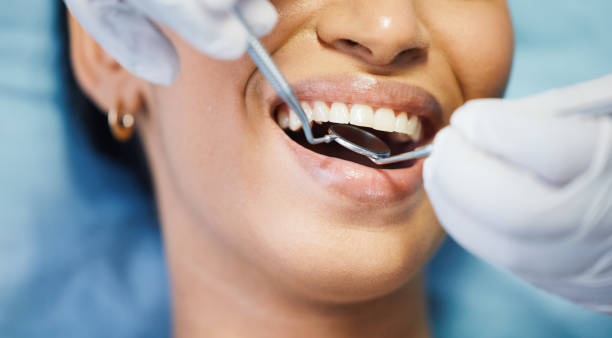Best Knocked-Out Tooth Emergency  in Lebanon, IN