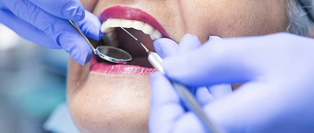 Best Broken Tooth Emergency  in Lebanon, IN